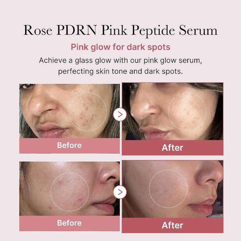 MEDICUBE Pdrn Pink Peptide Sérum – Image 2