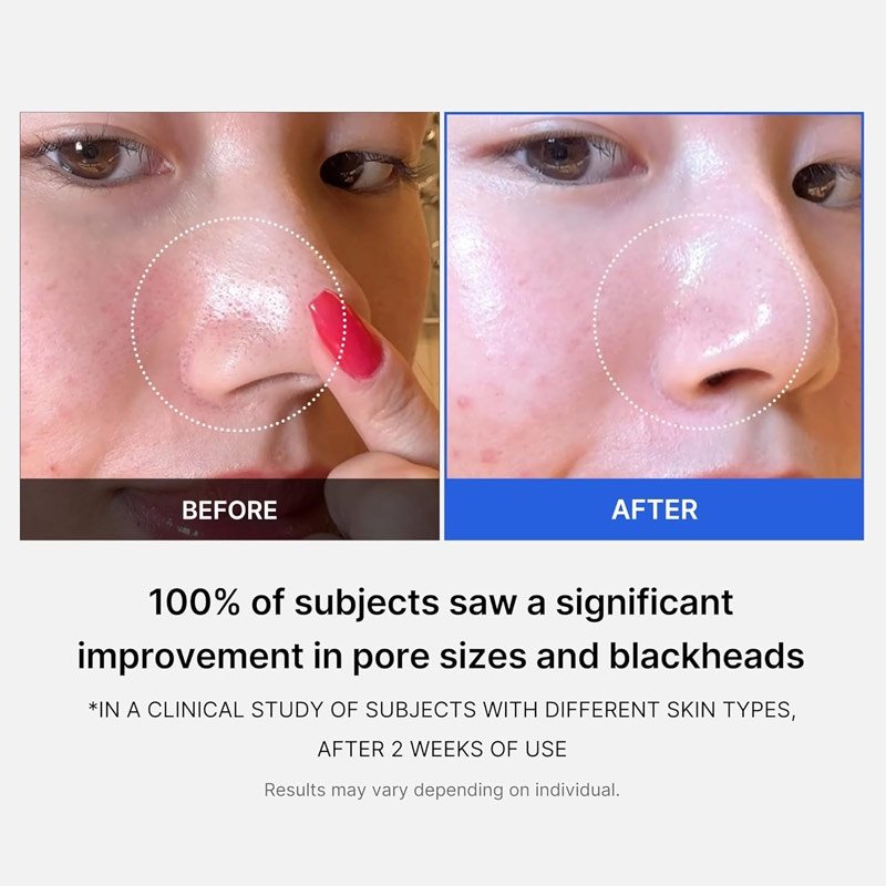 MEDICUBE Zero Pore 2.0 Pads Exfoliants Anti-pores – Image 3